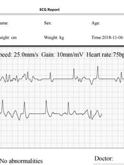 Load image into Gallery viewer, FL10 Portable ECG Monitor with Bluetooth, APP and PC software
