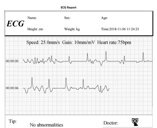 FL10 Portable ECG Monitor with Bluetooth, APP and PC software