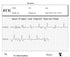 products/FL10-ecg-result-2.jpg