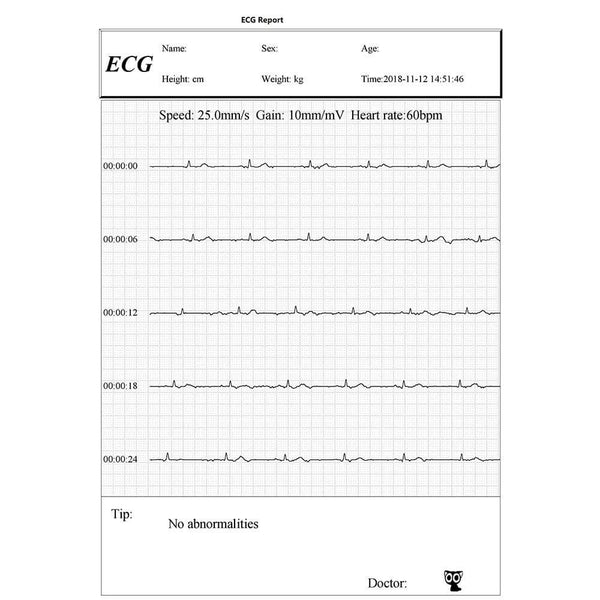 FL50 ECG Monitor with Pulse Oximeter
