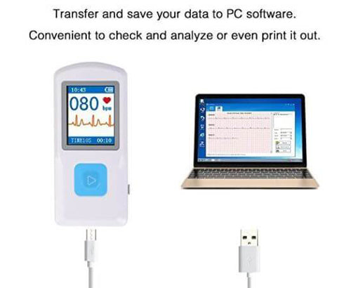 FL10 Portable ECG Monitor with Bluetooth, APP and PC software