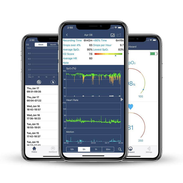 FL340 Pulse Oximeter with APP & PC Software, Vibration Notification