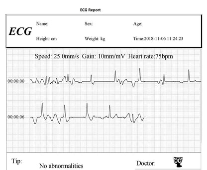 FL10 Portable ECG Monitor with Bluetooth, APP and PC software