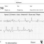 Load image into Gallery viewer, FL10 Portable ECG Monitor with Bluetooth, APP and PC software
