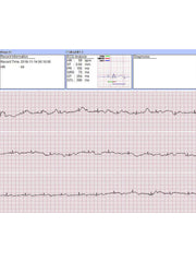 Load image into Gallery viewer, FL20 Handheld Portable ECG Monitor