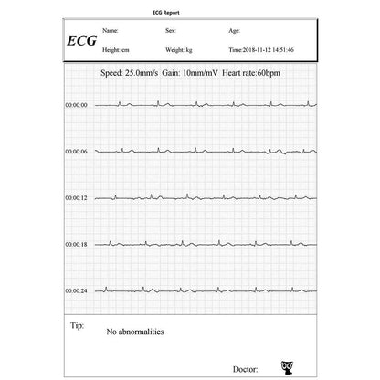 FL50 ECG Monitor with Pulse Oximeter
