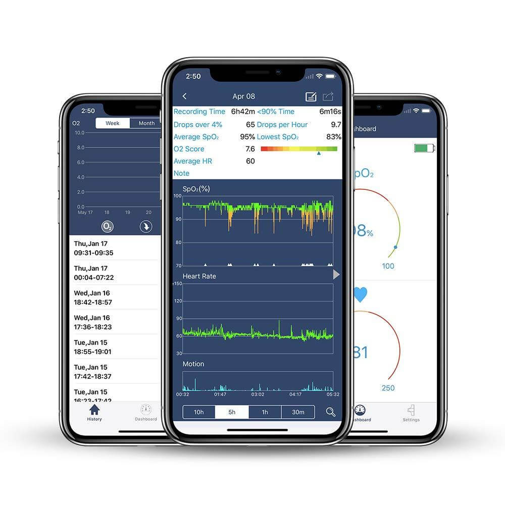FL340 Pulse Oximeter with APP & PC Software, Vibration Notification