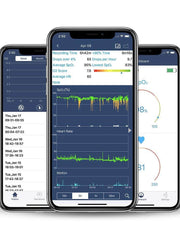 Load image into Gallery viewer, FL340 Pulse Oximeter with APP &amp; PC Software, Vibration Notification